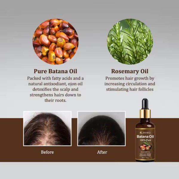Hair Growth oil