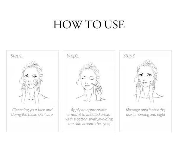 Aloe Vera Anti-Acne Cream