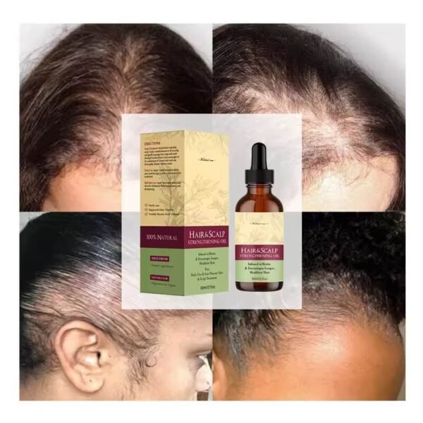 Hair Growth Oil