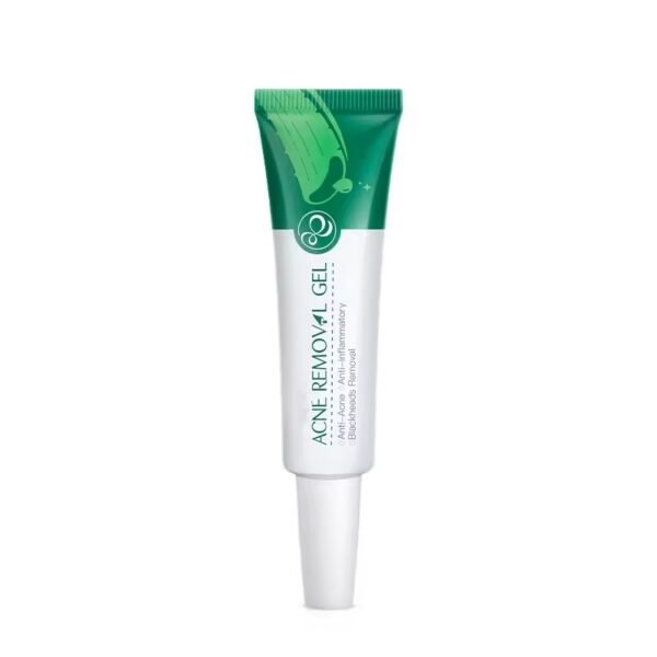 Aloe Vera Anti-Acne Cream