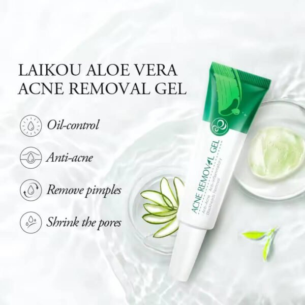 Aloe Vera Anti-Acne Cream