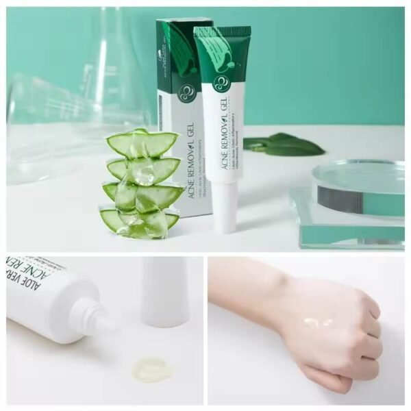 Aloe Vera Anti-Acne Cream