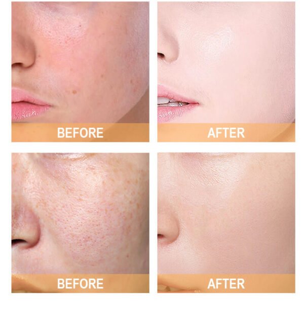 Hyaluronic Acid
