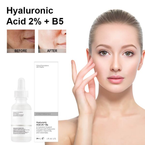 Hyaluronic Acid