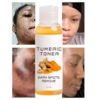 Acne Remover Toner