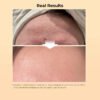 Repair Serum