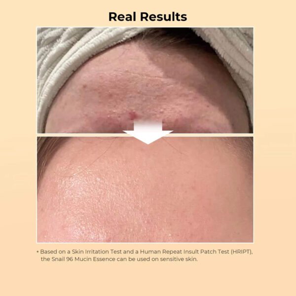 Repair Serum