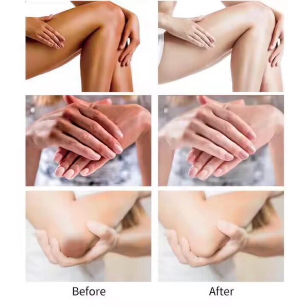 Private Parts Whitening Cream