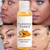 Acne Remover Toner