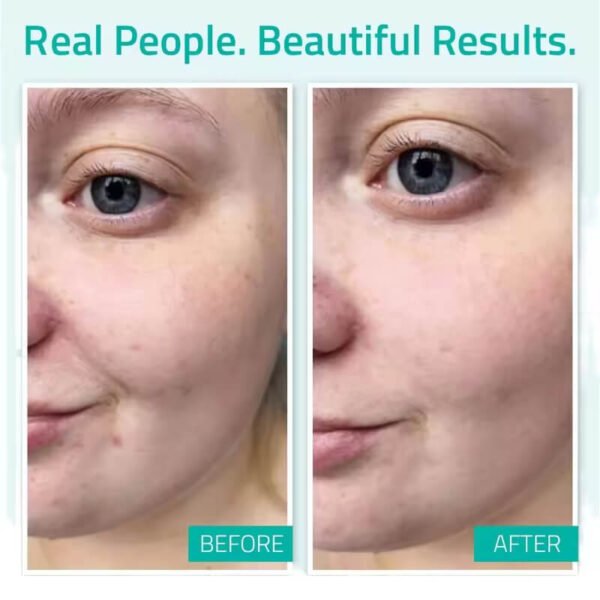 Anti-aging Face Serum