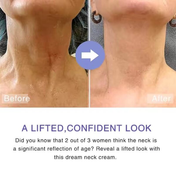 Neck cream