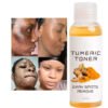 Acne Remover Toner