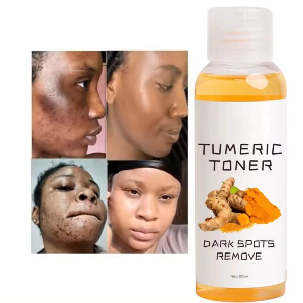 Acne Remover Toner