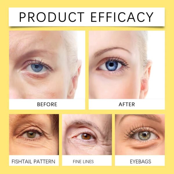 Snail Hydrogel Eye Patch