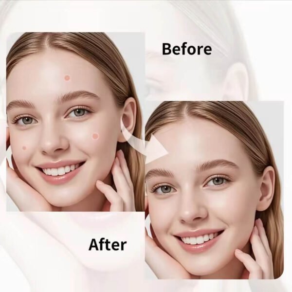 Hydrocolloid Acne Pimple Patch