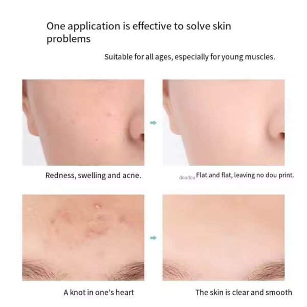 Salicylic Acid Pads