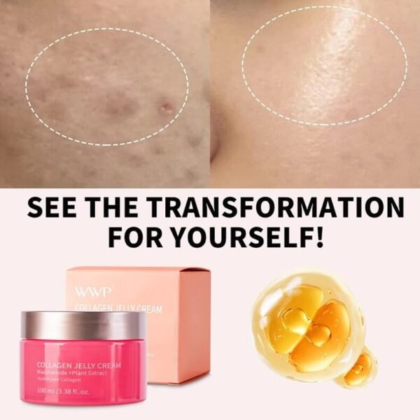 Collagen Jelly Cream