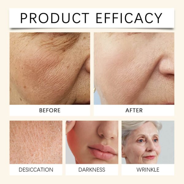 Arbutin Nicotinamide VC Facial Whitening Serum Anti Aging Skin Essential Oil Essences Visage Face Care Serum - 图片 5