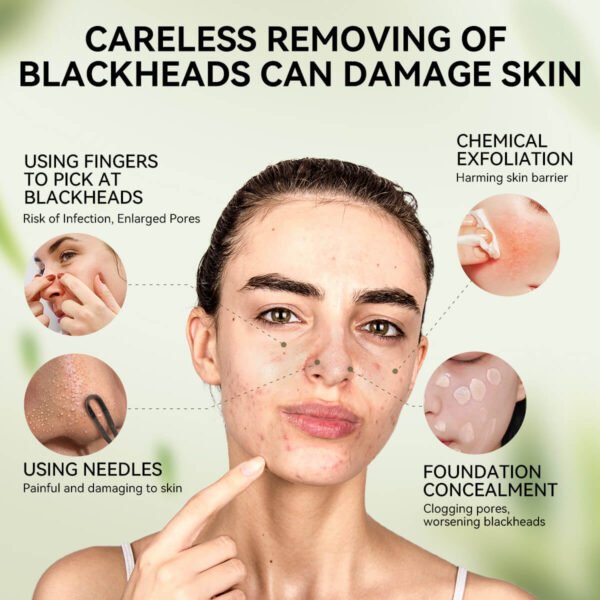 Nose Blackhead Remover Mask