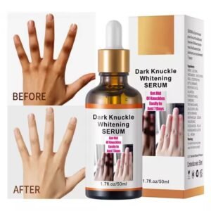 Dark Knuckles Whitening Serum