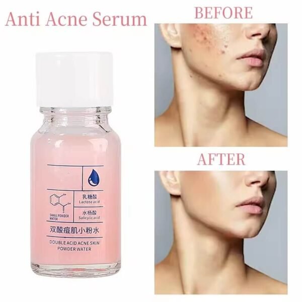 Salicylic Acid Pads