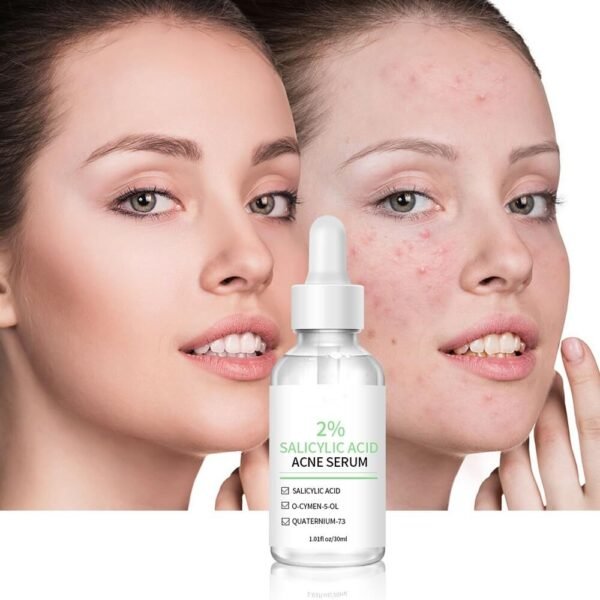 Anti-acne essence