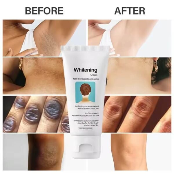 whitening skin whitening cream