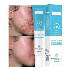 Salicylic Acid Acne Gel