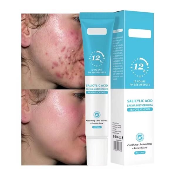Salicylic Acid Acne Gel