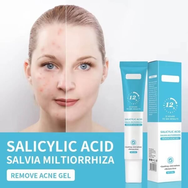 Salicylic Acid Acne Gel